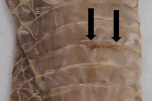 Snake skin shed lesions